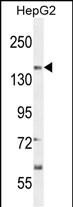 CT117 Antibody (N-term) (Cat. #AP10979a) western blot analysis in HepG2 cell line lysates (35ug/lane).This demonstrates the CT117 antibody detected the CT117 protein (arrow).