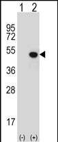WB - JMJD5 Antibody (N-term) AP10986a