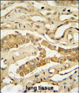 IHC-P - NDUF3 Antibody (N-term) AP10989a