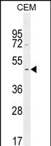 GDPD5 Antibody (center) (Cat. #AP10992c) western blot analysis in CEM cell line lysates (35ug/lane).This demonstrates the GDPD5 antibody detected the GDPD5 protein (arrow).