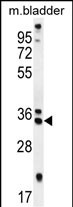 WB - REEP4 Antibody (C-term) AP10994b