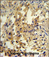 IHC-P - UPP2 Antibody  (C-term) AP10995b