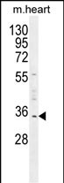 WB - UPP2 Antibody  (C-term) AP10995b
