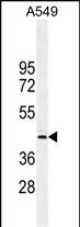 WB - CT112 Antibody (Center) AP10996c