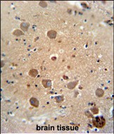 IHC-P - CF062 Antibody (Center) AP10998c