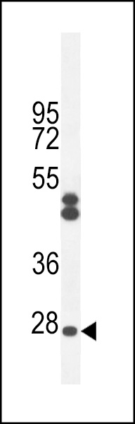 CF062 Antibody  (Center) (Cat. #AP10998c) western blot analysis in CHO cell line lysates (35ug/lane).This demonstrates the CF062 antibody detected the CF062 protein (arrow).