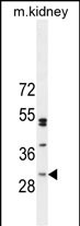 WB - CF062 Antibody (Center) AP10998c