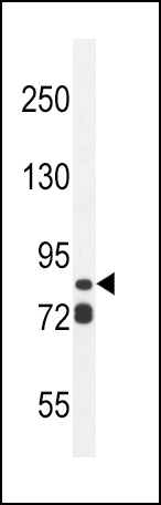 ASAP3 Antibody  (N-term) (Cat. #AP11003a) western blot analysis in ZR-75-1 cell line lysates (35ug/lane).This demonstrates the ASAP3 antibody detected the ASAP3 protein (arrow).