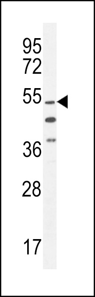WB - CO044 Antibody (C-term) AP11005b