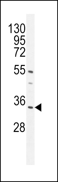 WB - CR025 Antibody (Center) AP11006c