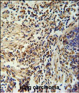 IHC-P - ZNF720 Antibody (Center) AP11021c