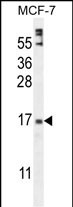 WB - ZNF720 Antibody (Center) AP11021c