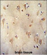 IHC-P - LRC40 Antibody  (C-term) AP11024b