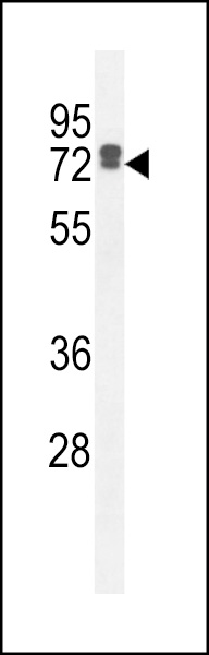 WB - LRC40 Antibody  (C-term) AP11024b