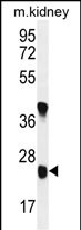 WB - U119B Antibody  (C-term) AP11026b