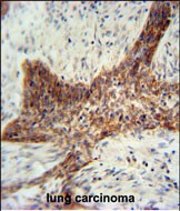 IHC-P - RILPL2 Antibody (Center) AP11028c