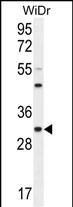 RILPL2 Antibody (Center) (Cat. #AP11028c) western blot analysis in WiDr cell line lysates (35ug/lane).This demonstrates the RILPL2 antibody detected the RILPL2 protein (arrow).