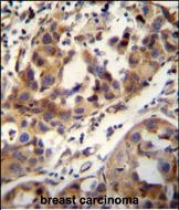 IHC-P - CCDC17 Antibody (C-term) AP11038b