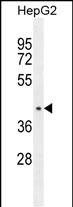 WB - CCDC17 Antibody (C-term) AP11038b