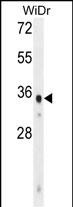 WB - WDR5B Antibody (N-term) AP11053a