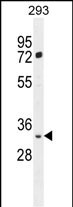 WB - FRG2B Antibody (N-term) AP11071a