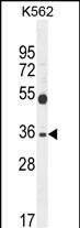 WB - SULT1C3 Antibody (C-term) AP11072b