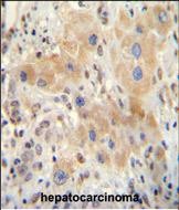 IHC-P - NR0B2 Antibody (Center) AP11075c