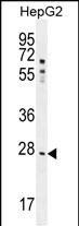 WB - NR0B2 Antibody (Center) AP11075c