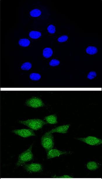 Confocal immunofluorescent analysis of AIRE Antibody (Center)(Cat. #AP11079c) with 293 cell followed by Alexa Fluor� 488-conjugated goat anti-rabbit lgG (green). DAPI was used to stain the cell nuclear (blue).