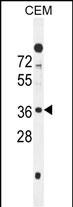 WB - SFR1 Antibody (N-term) AP11080A