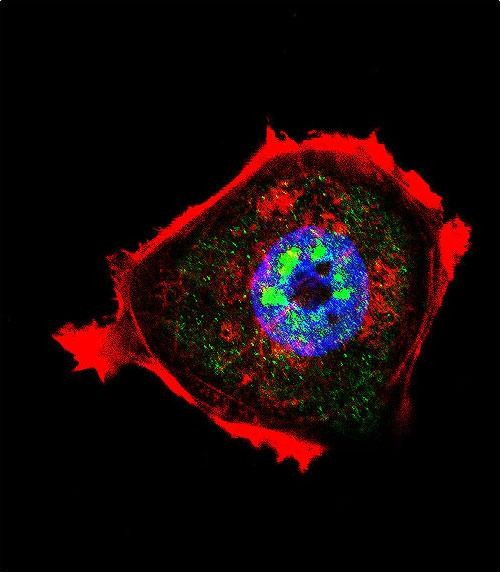 Confocal immunofluorescent analysis of Phospho-AKT1 (Thr308) Antibody(Cat#AP3743a) with MCF-7 cell followed by Alexa Fluor 488-conjugated goat anti-rabbit lgG (green).Actin filaments have been labeled with Alexa Fluor 555 phalloidin (red).DAPI was used to stain the cell nuclear (blue).