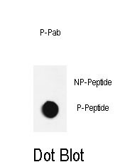 Dot blot analysis of anti-Phospho-JNK1-T183/Y185 Phospho-specific Pab (Cat. #AP3752a) on nitrocellulose membrane. 50ng of Phospho-peptide or Non Phospho-peptide per dot were adsorbed. Antibody working concentrations are 0.6ug per ml.