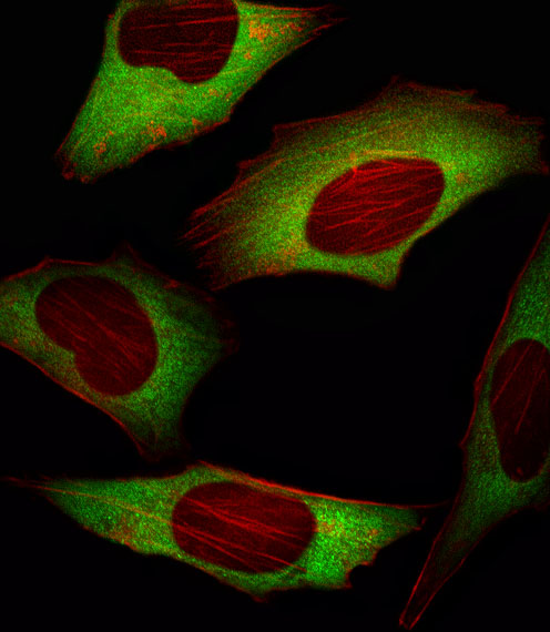 Fluorescent image of Hela cell stained with EIF4E Antibody(Cat#AM1852b/SG101020AF).Hela cells were fixed with 4% PFA (20 min), permeabilized with Triton X-100 (0.1%, 10 min), then incubated with EIF4E primary antibody (1:25, 1 h at 37?. For secondary antibody, Alexa Fluor� 488 conjugated donkey anti-mouse antibody (green) was used (1:400, 50 min at 37?.Cytoplasmic actin was counterstained with Alexa Fluor� 555 (red) conjugated Phalloidin (7units/ml, 1 h at 37?. EIF4E immunoreactivity is localized to Cytoplasm significantly.
