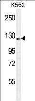 AASS Antibody (C-term) (Cat. #AP11094b) western blot analysis in K562 cell line lysates (35ug/lane).This demonstrates the AASS antibody detected the AASS protein (arrow).