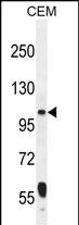 WB - LARS2 Antibody (Center) AP11098c