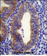 IHC-P - FGD6 Antibody (C-term) AP11108b