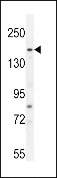 WB - FGD6 Antibody (C-term) AP11108b