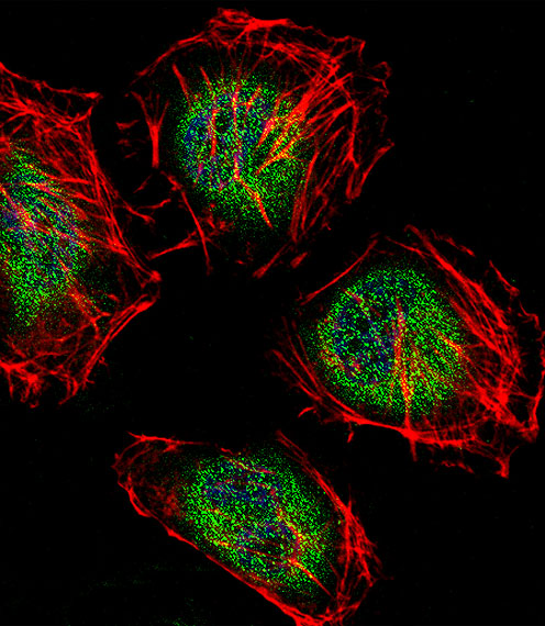Fluorescent confocal image of Hela cell stained with CAF-1 Antibody (N-term)(Cat#AP11112a).Hela cells were fixed with 4% PFA (20 min), permeabilized with Triton X-100 (0.1%, 10 min), then incubated with CAF-1 primary antibody (1:25, 1 h at 37?). For secondary antibody, Alexa Fluor� 488 conjugated donkey anti-rabbit antibody (green) was used (1:400, 50 min at 37?).Cytoplasmic actin was counterstained with Alexa Fluor� 555 (red) conjugated Phalloidin (7units/ml, 1 h at 37?). Nuclei were counterstained with DAPI (blue) (10 �g/ml, 10 min). CAF-1 immunoreactivity is localized to Cytoplasm and Nucleus significantly.