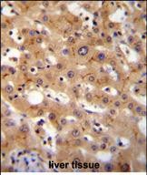 IHC-P - GGCX Antibody (Center) AP11117c