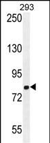 WB - GGCX Antibody (Center) AP11117c
