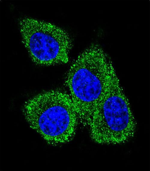 Confocal immunofluorescent analysis of GCDFP-15 Antibody (C-term) (Cat#AP11122b) with MDA-MB231 cell followed by Alexa Fluor 488-conjugated goat anti-rabbit lgG (green). DAPI was used to stain the cell nuclear (blue).