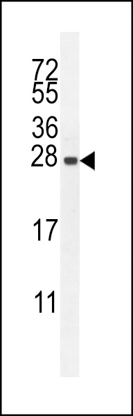 IRGM Antibody (C-term) (Cat. #AP11128b) western blot analysis in HepG2 cell line lysates (35ug/lane).This demonstrates the IRGM antibody detected the IRGM protein (arrow).