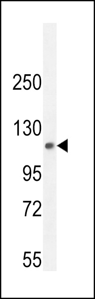 WB - PHF12 Antibody (C-term) AP11130b