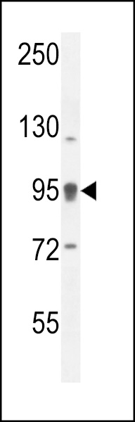 ACAP1 Antibody (N-term) (Cat. #AP11134a) western blot analysis in ZR-75-1 cell line lysates (35ug/lane).This demonstrates the ACAP1 antibody detected the ACAP1 protein (arrow).