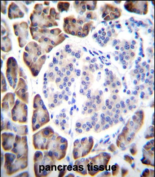 IHC-P - UROC1 Antibody (Center) AP11147C