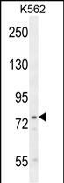 WB - UROC1 Antibody (Center) AP11147C