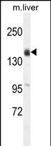 WB - OTOA Antibody (N-term) AP11149a