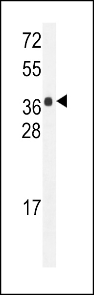 WB - HARB1 Antibody (N-term) AP11152a