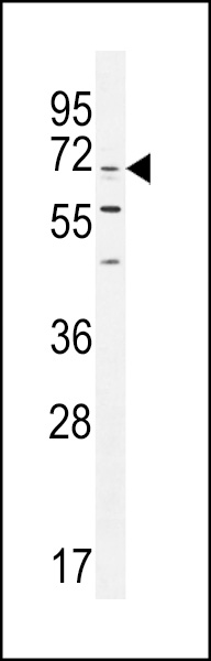 WB - CPSF3L Antibody (N-term) AP11162A