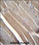 IHC-P - TRMT2B Antibody (N-term) AP11166a